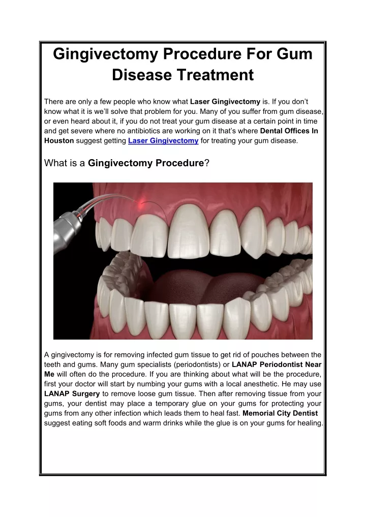 PPT - Gingivectomy Procedure For Gum Disease Treatment PowerPoint ...