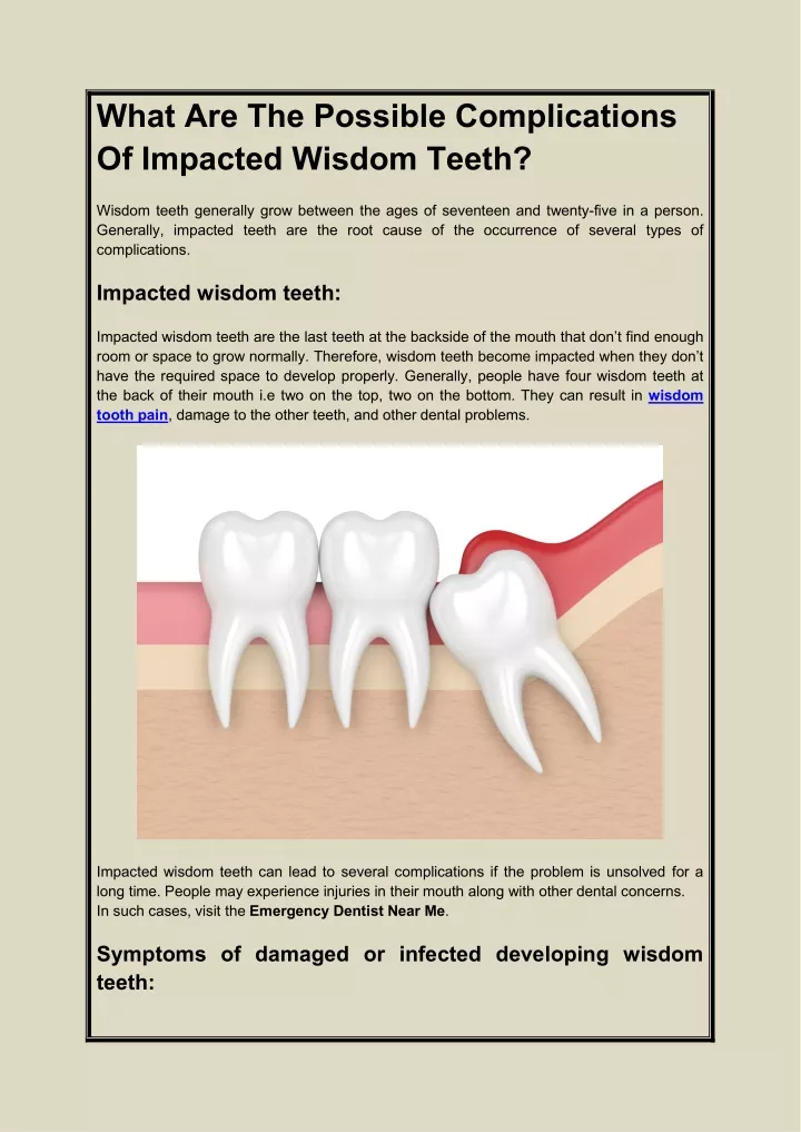 Ppt What Are The Possible Complications Of Impacted Wisdom Teeth Powerpoint Presentation Id 8716