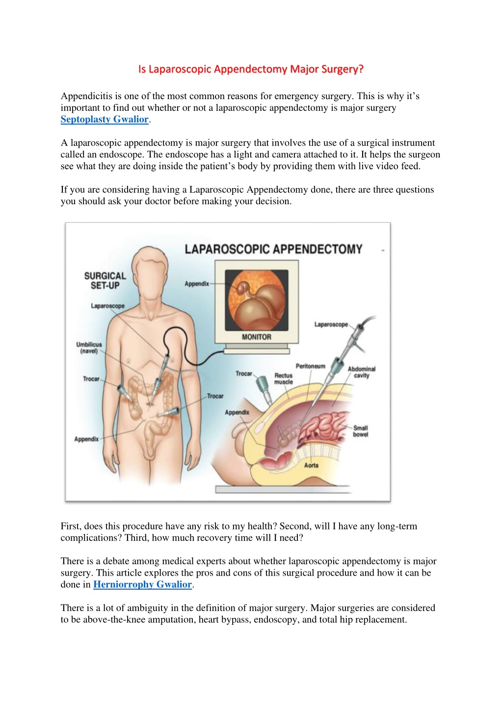 Ppt Is Laparoscopic Appendectomy Major Surgery Powerpoint