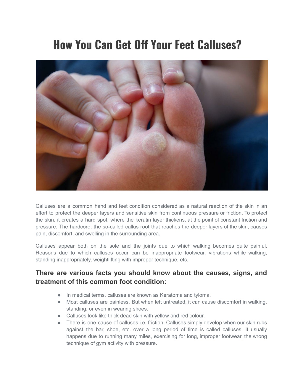 PPT - How You Can Get Off Your Feet Calluses PowerPoint Presentation ...