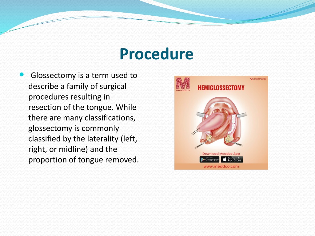 PPT - Hemiglossectomy PowerPoint Presentation, free download - ID:10997442