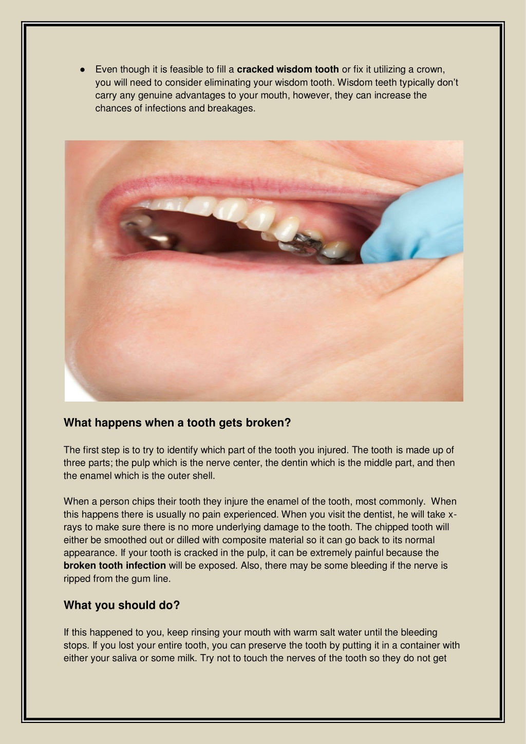 PPT What are the Complications After Having A Broken Wisdom Tooth