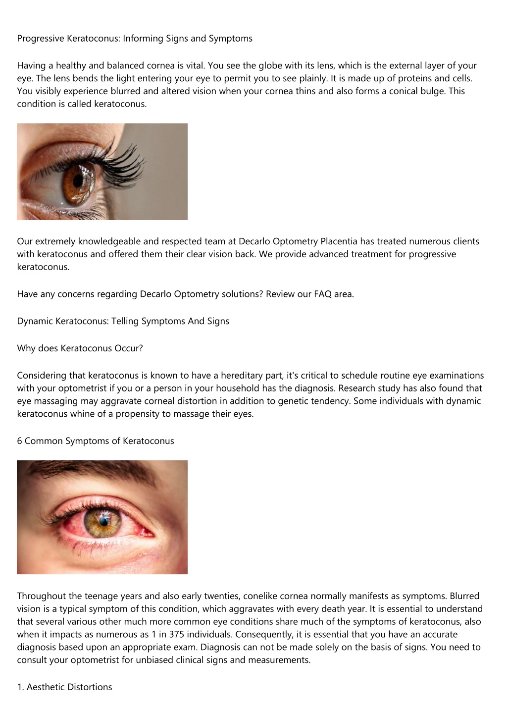 PPT - The Defining Signs Of A Progressive Keratoconus Condition ...