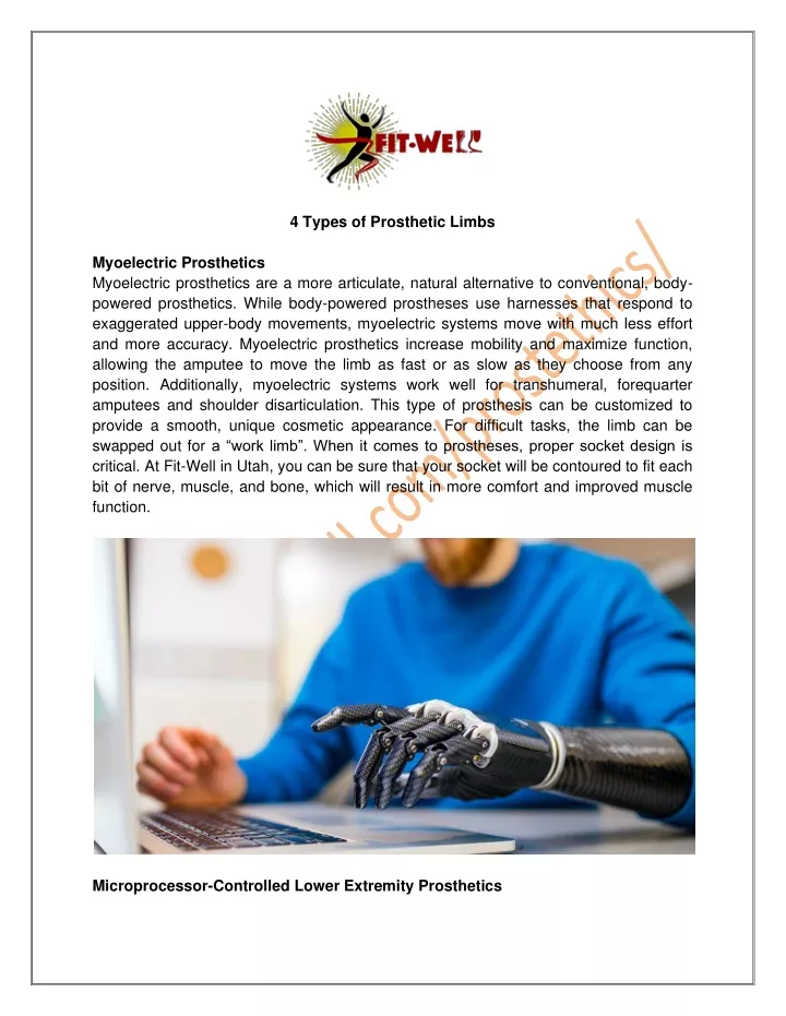 ppt-4-types-of-prosthetic-limbs-powerpoint-presentation-free