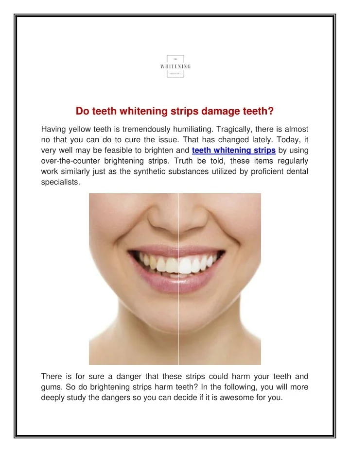 PPT Do teeth whitening strips damage teeth PowerPoint Presentation