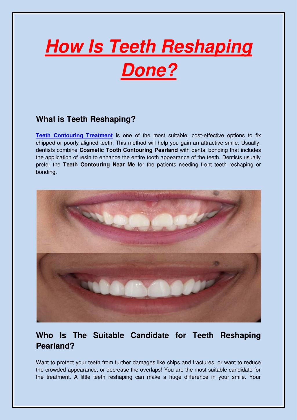 Ppt How Is Teeth Reshaping Done Powerpoint Presentation Free Download Id 11058409