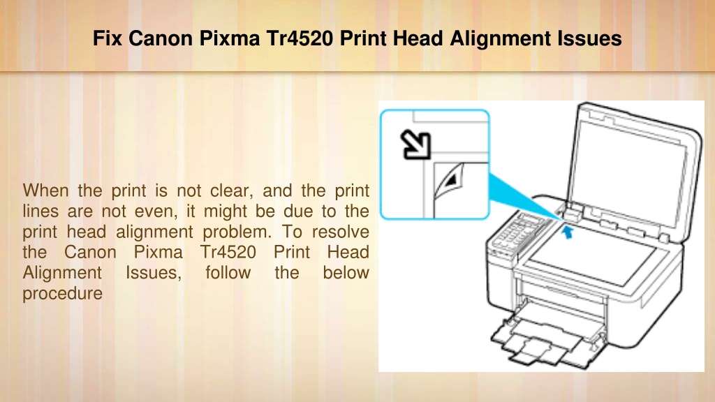 Ppt Fix Canon Pixma Tr4520 Print Head Alignment Issues Try This Method Powerpoint 6711