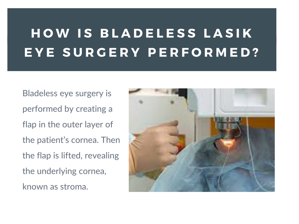 Ppt A Guide To Bladeless Lasik Eye Surgery Powerpoint Presentation