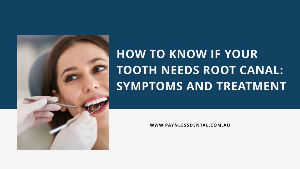 PPT - How To Know If Your Tooth Needs Root Canal Symptoms And Treatment ...