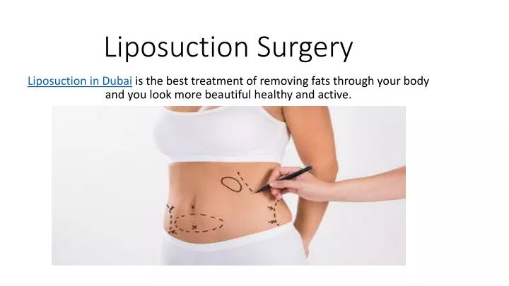 Ppt Liposuction Surgery Powerpoint Presentation Free Download Id