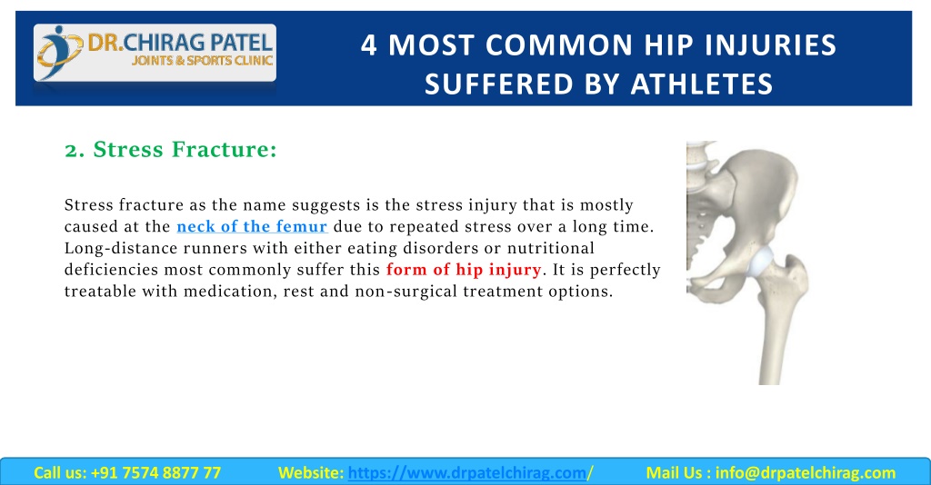 PPT - 4 Most Common Hip Injuries Suffered By Athletes | Dr. Chirag ...