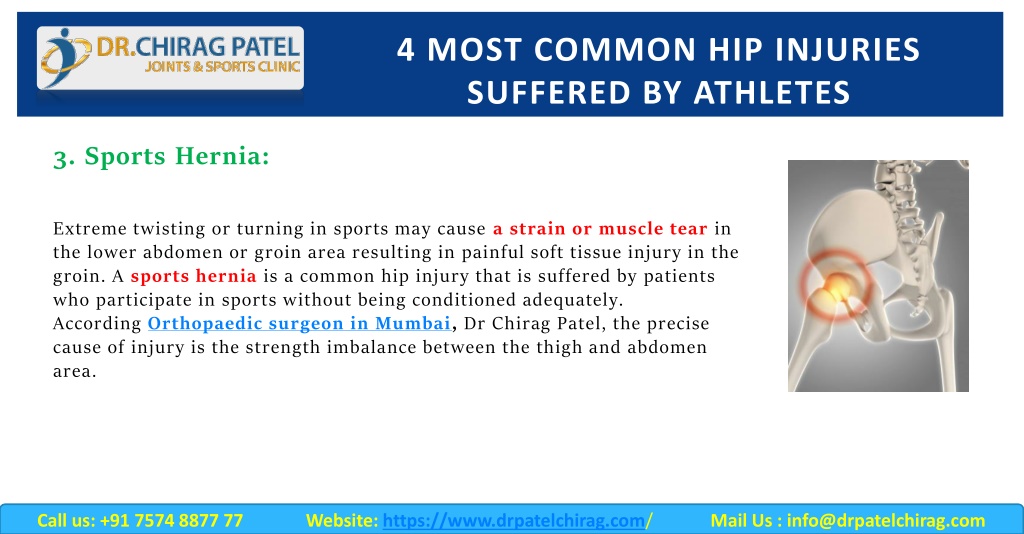 PPT - 4 Most Common Hip Injuries Suffered By Athletes | Dr. Chirag ...