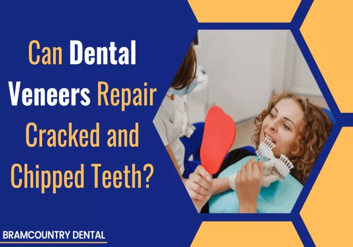 PPT - Can Dental Veneers Repair Cracked and Chipped Teeth? PowerPoint ...