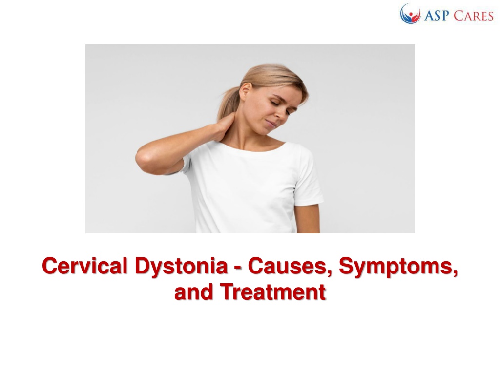 Ppt Cervical Dystonia Causes Symptoms And Treatment Powerpoint Presentation Id11117871 0752