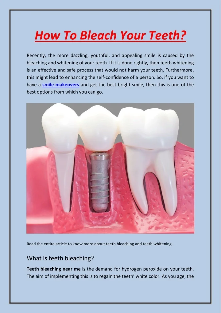 PPT How To Bleach Your Teeth PowerPoint Presentation, free download