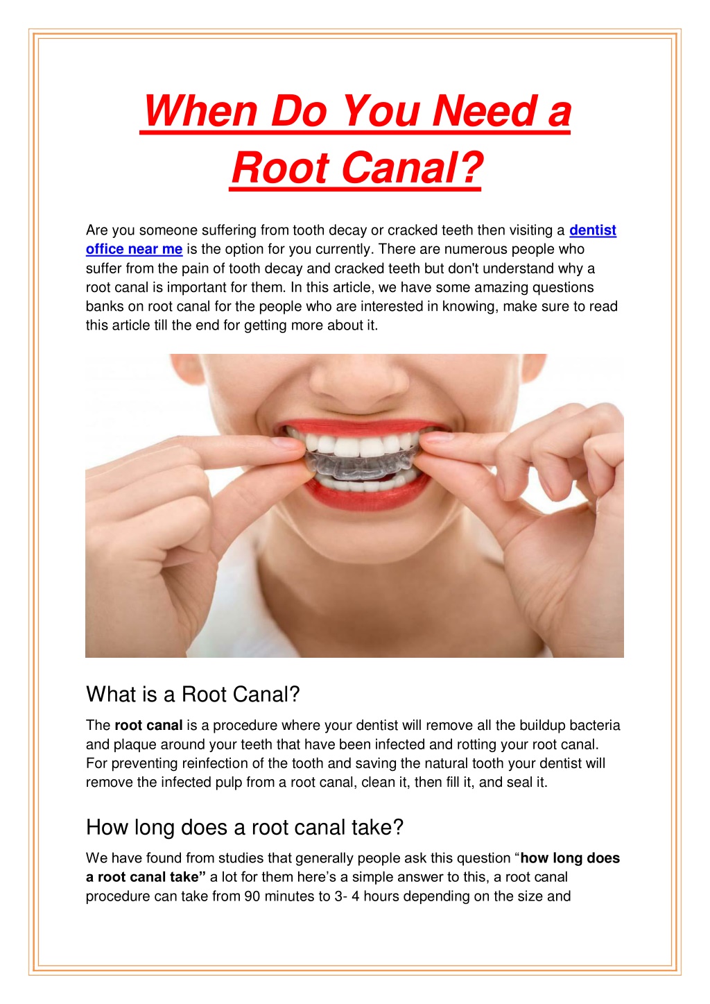 ppt-when-do-you-need-a-root-canal-powerpoint-presentation-free