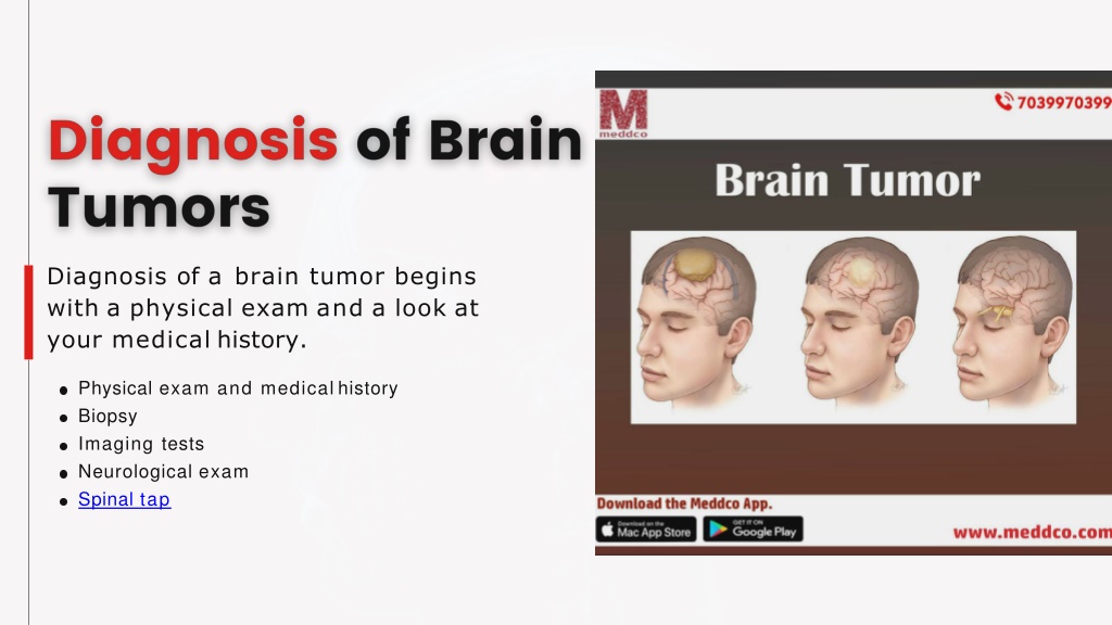 PPT - Meddco PPt of Brain Tumor Excision Of Brain Tumor PowerPoint ...