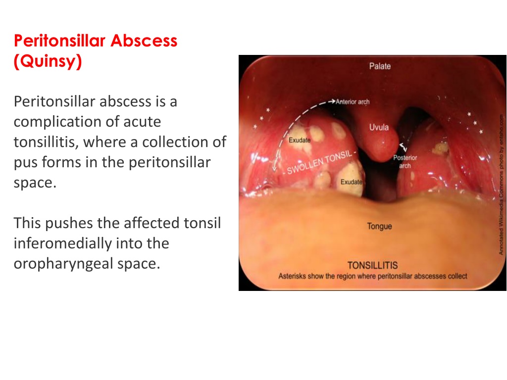 PPT - 1- Anatomy of oral cavity PowerPoint Presentation, free download ...