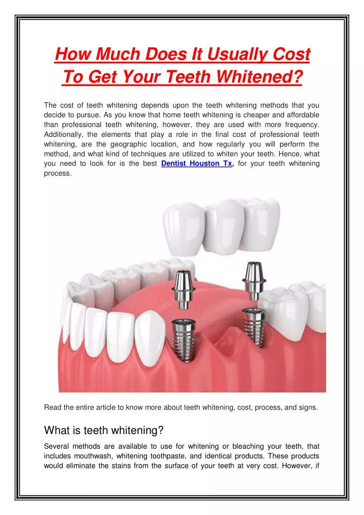 PPT - How Much Does It Usually Cost To Get Your Teeth Whitened