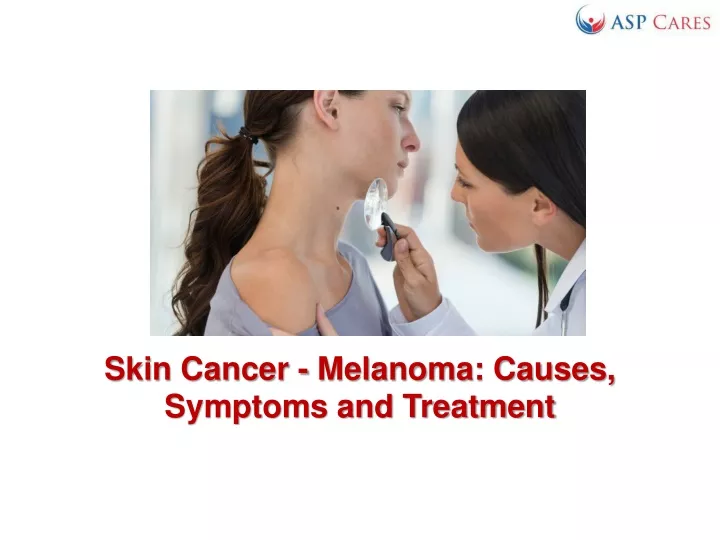 PPT - Skin Cancer - Melanoma - Causes, Symptoms And Treatment ...