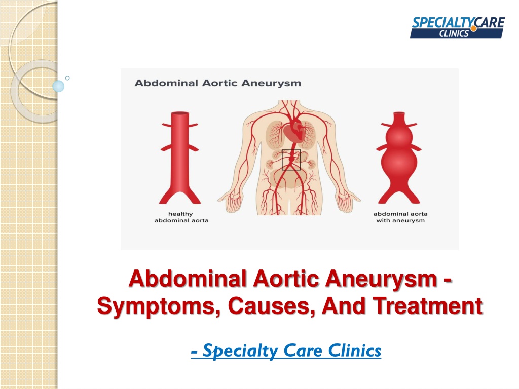 Ppt Abdominal Aortic Aneurysm Symptoms Causes And Treatment