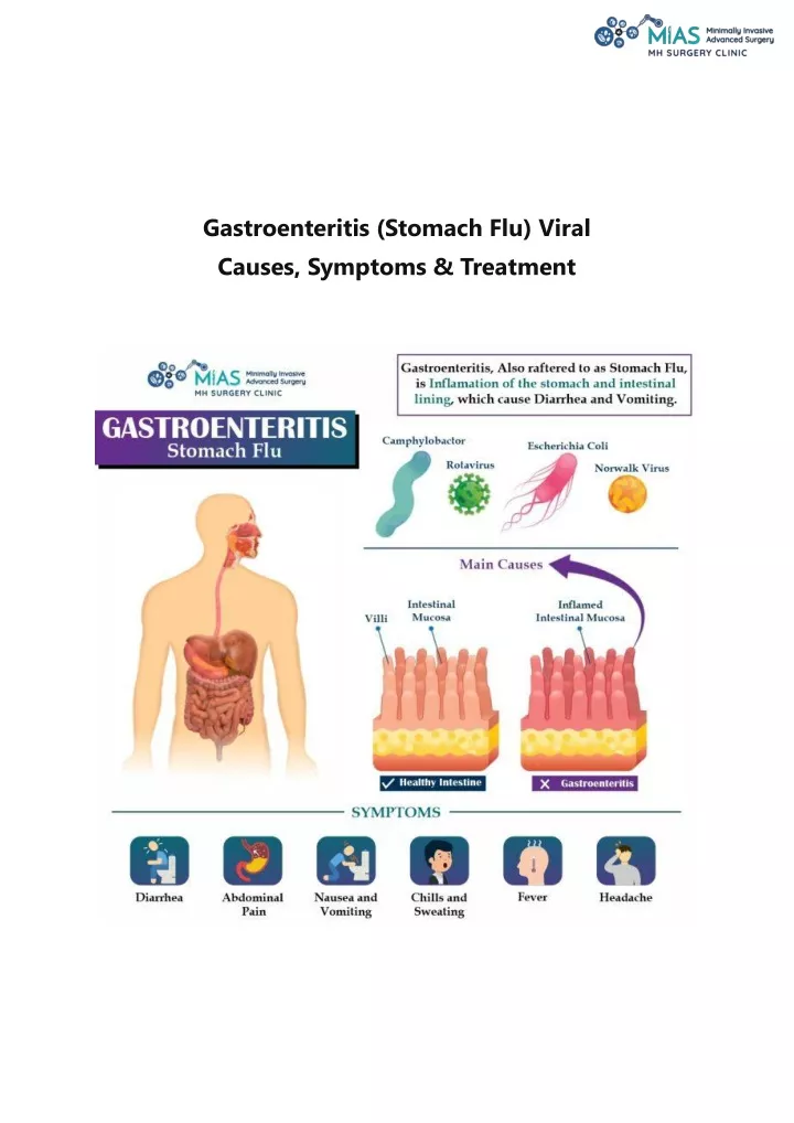 PPT - Gastroenteritis (Stomach Flu) Viral Causes, Symptoms & Treatment ...