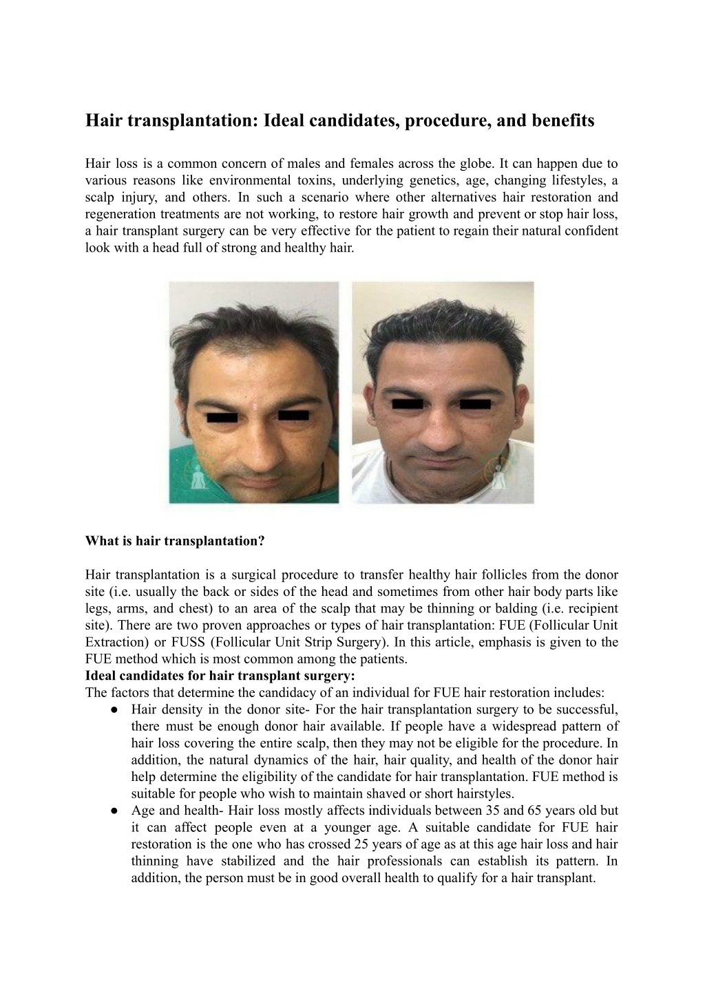 Ppt Hair Transplantation Ideal Candidates Procedure And Benefits Powerpoint Presentation 8349