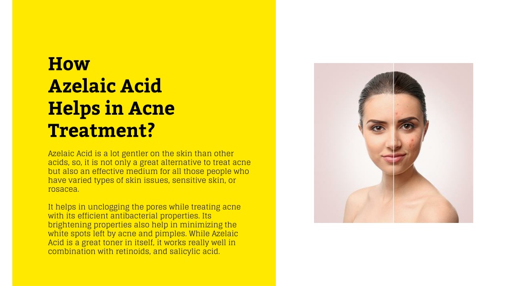 PPT - Azelaic Acid Serum for Acne and Dark Spots. Does it Work for Real