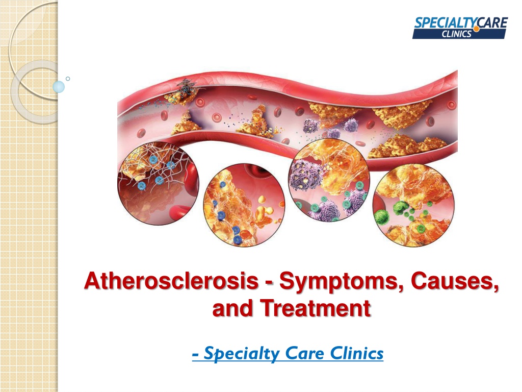 atherosclerosis case study ppt