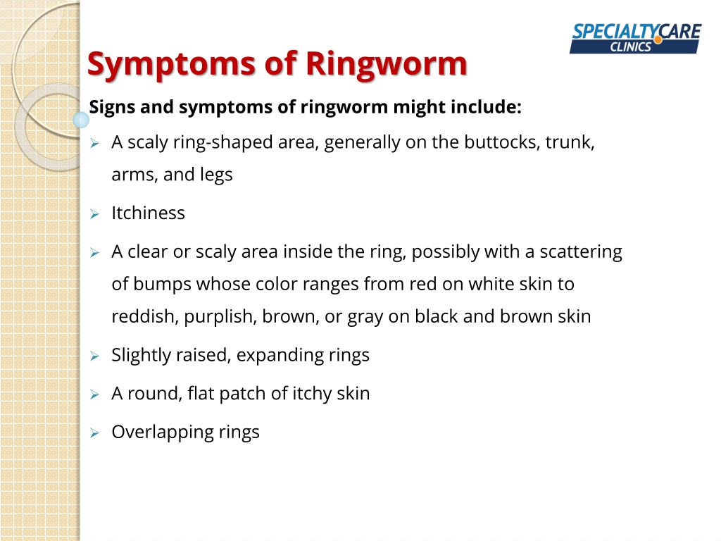 Ppt Ringworm Body Symptoms Causes And Treatment Powerpoint