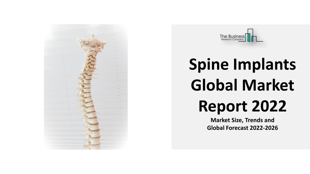 PPT - Spine Implants Market To Witness Significant Growth In Coming ...