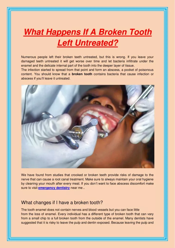 ppt-what-happens-if-a-broken-tooth-left-untreated-powerpoint