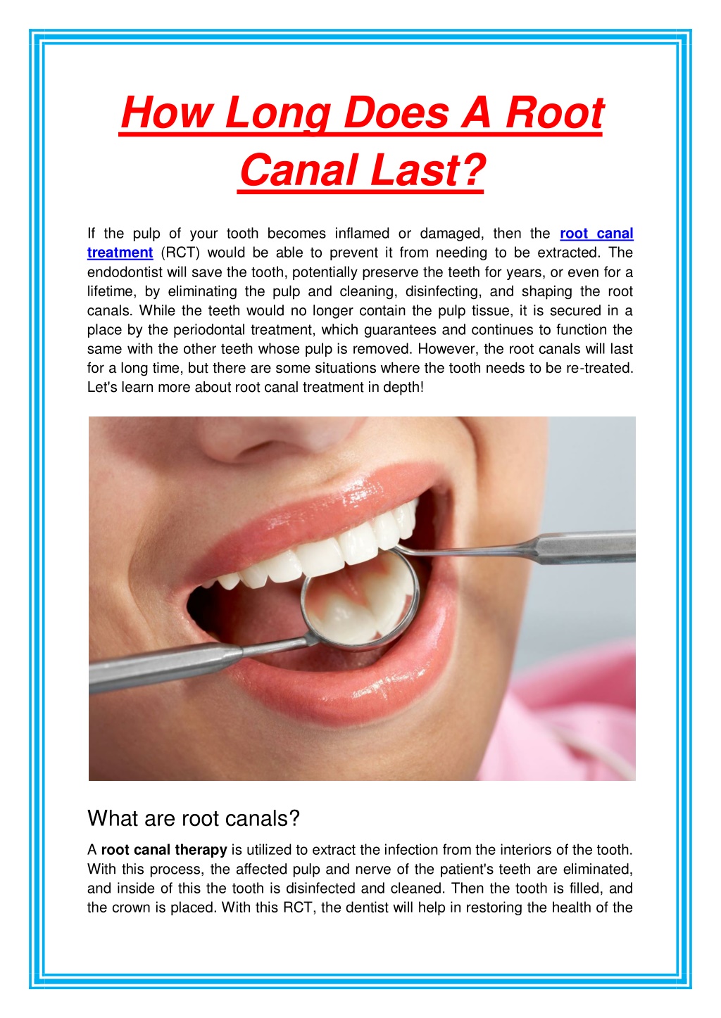 ppt-how-long-does-a-root-canal-last-powerpoint-presentation-free