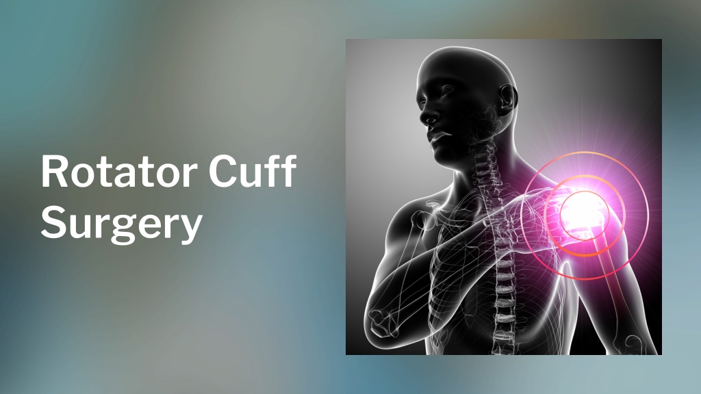 PPT - Rotator cuff surgery in Coimbatore PowerPoint Presentation, free ...