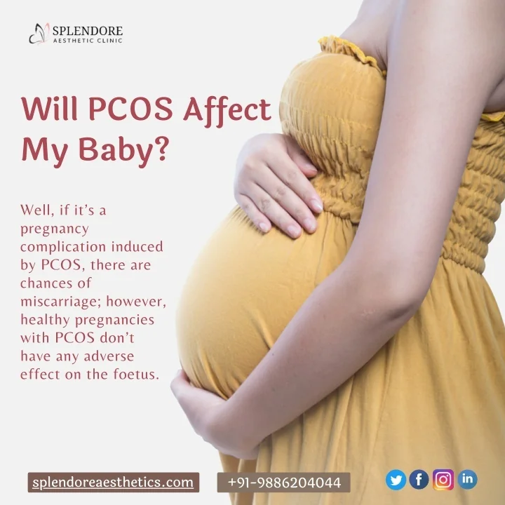 PPT Will PCOS Affect My Baby Best Gynec Cosmetologist In HSR Layout 