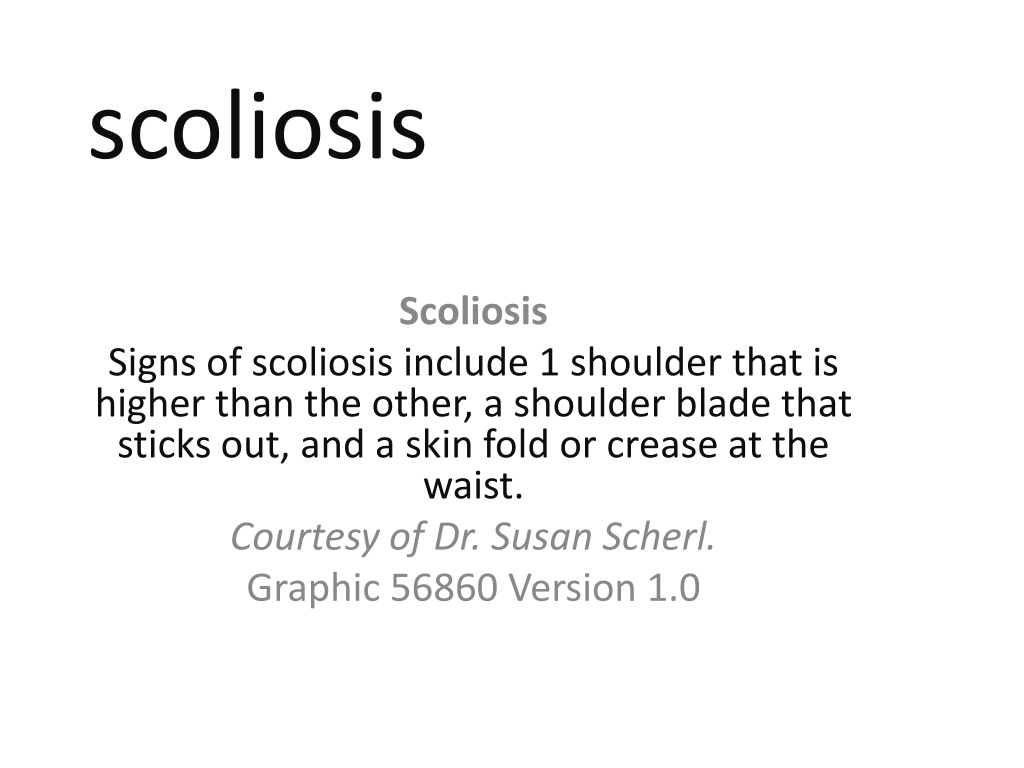 PPT - Scoliosis PowerPoint Presentation, Free Download - ID:11258992