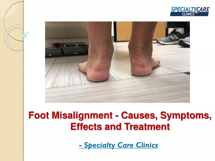 PPT - Foot Misalignment - Causes, Symptoms, Effects and Treatment ...