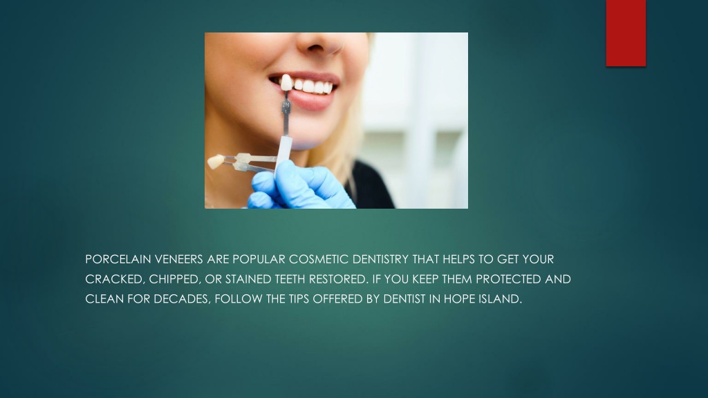 Ppt Can Porcelain Veneers Break Easily Powerpoint Presentation Free Download Id