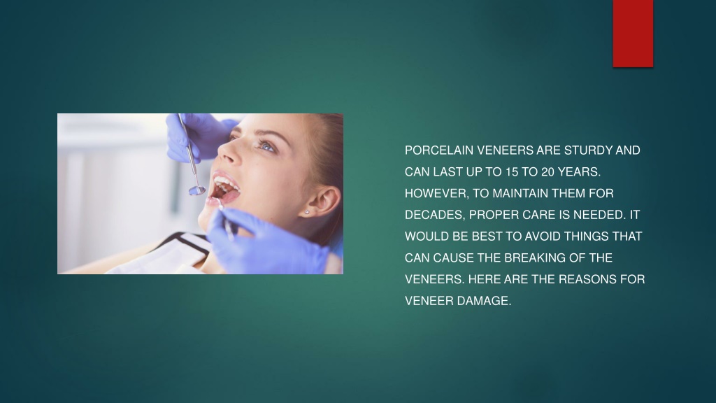 Ppt Can Porcelain Veneers Break Easily Powerpoint Presentation Free