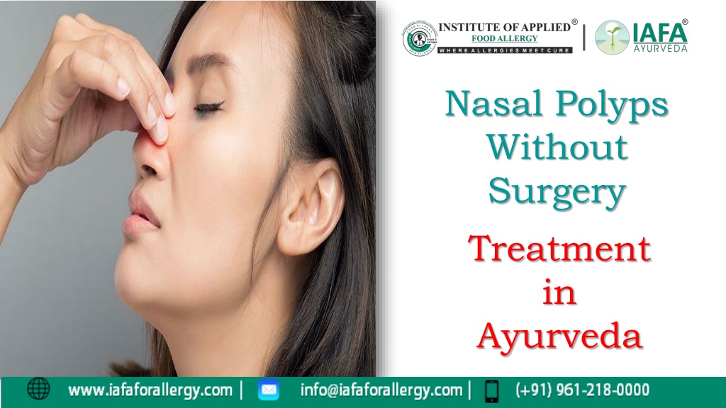 Ppt - Nasal Polyps Without Surgery Treatment In Ayurveda Powerpoint 