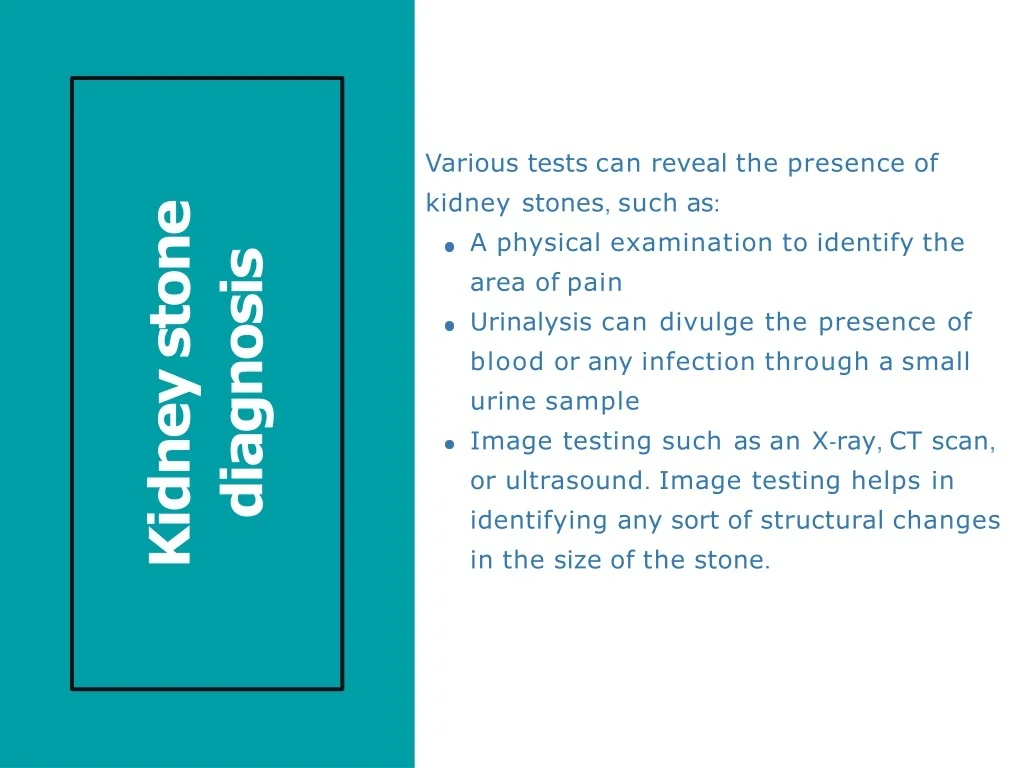 PPT Kidney stones 10 symptoms, causes, types diagnosis & Treatment