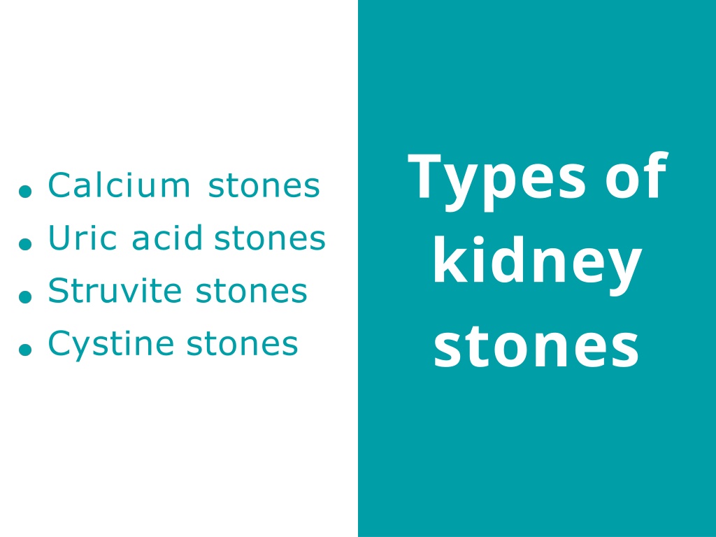 PPT - Kidney stones : 10 symptoms, causes, types diagnosis & Treatment ...