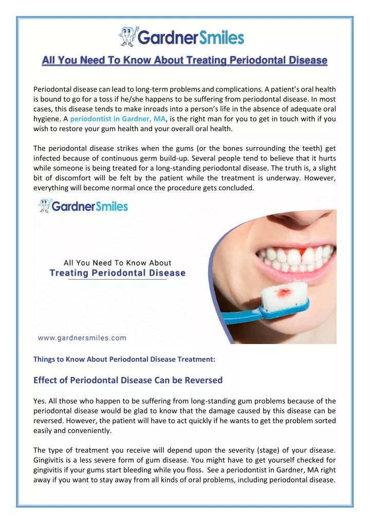 PPT - Everything You Need to Know About Periodontal Treatment ...