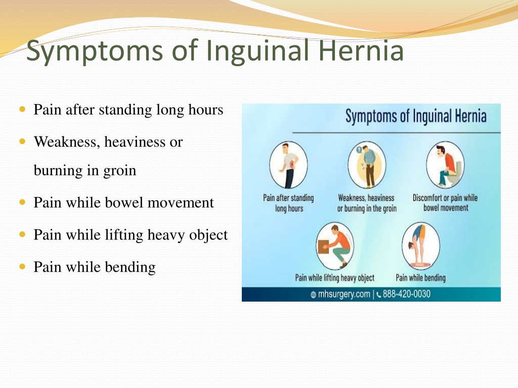 Ppt Inguinal Hernia Types Symptoms Diagnosis And Treatments Powerpoint Presentation Id11289133 