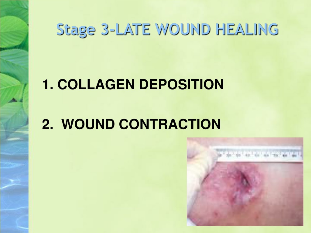 Management of the burst abdomen.ppt