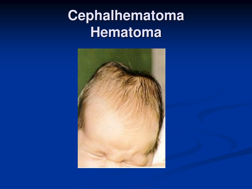 PPT - Birth Trauma PowerPoint Presentation, free download - ID:9307623