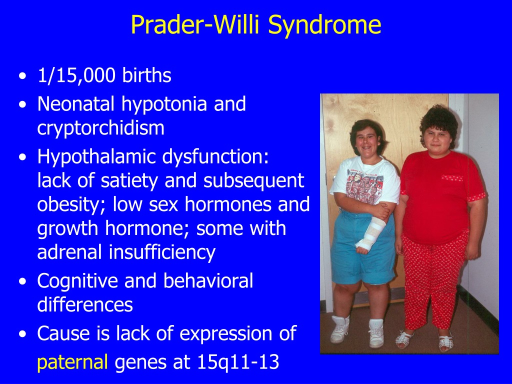 PPT Update On Medical Issues In Prader Willi Syndrome PowerPoint 