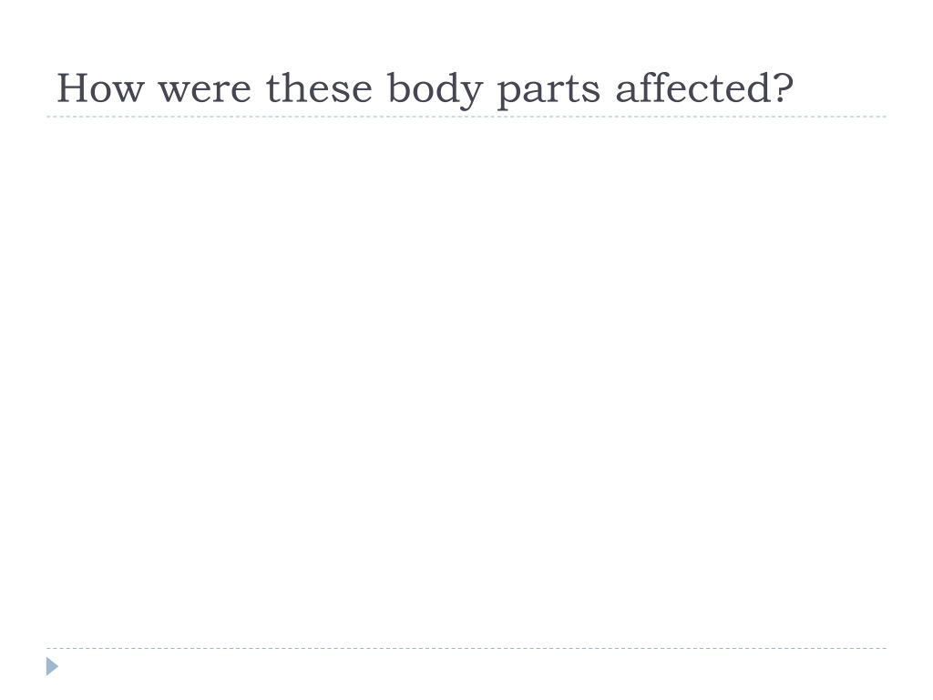 what body parts are affected by scid