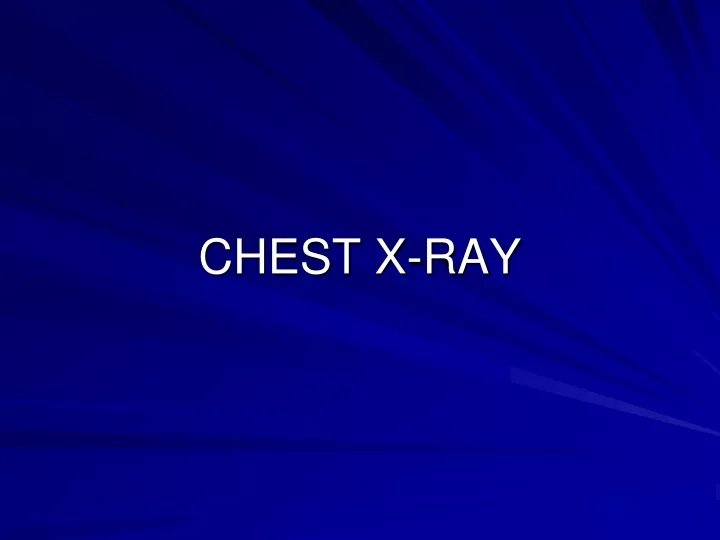 chest x ray n.