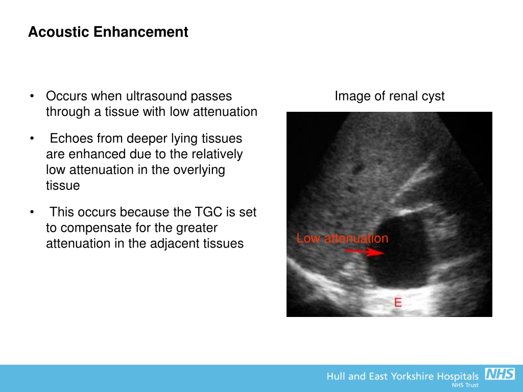 PPT - FRCR Physics Lectures The Physics Of Diagnostic Ultrasound Mark ...